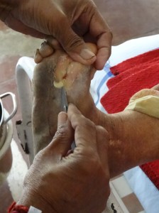 Skill with the scalpel 